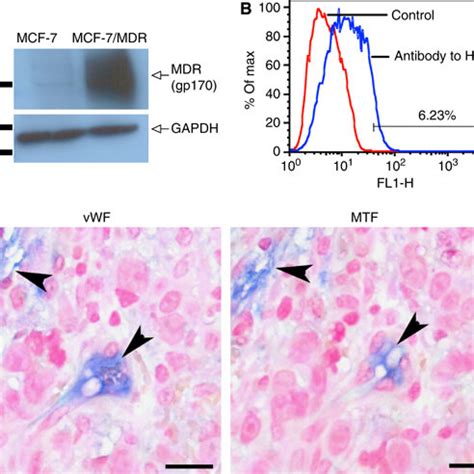 Tissue Factor Tf Expression By Chemoresistant Breast Cancer Mcf Mdr