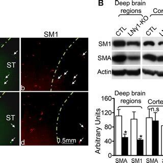 Region specific VSMC contractile protein expression changes in LNγ1 KO