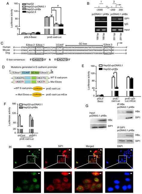 SIP1 Serves A Role In HBxinduced Liver Cancer Growth And Metastasis