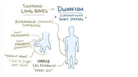 Achondroplasia – Symptoms, Causes - York Rehab Clinic