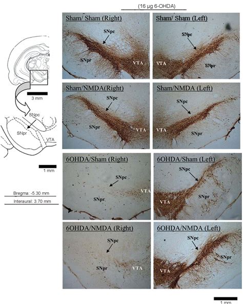 Figure 5 from Lesion of the subthalamic nucleus reverses motor deficits ...