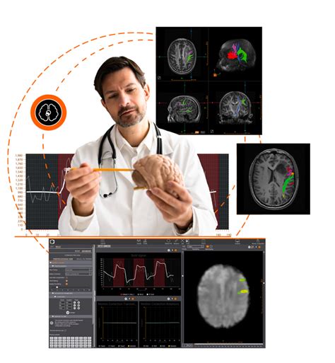 Functional Magnetic Resonance Imaging Solution Fmri Olea Medical