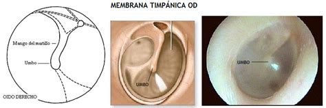 Membrana Timpánica Audiología Didáctica Para Estudiantes