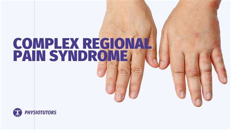 Complex Regional Pain Syndrome Crps Wrist Hand Youtube