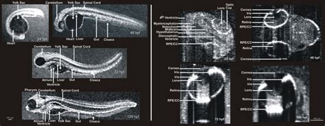 Visualization Of Developing Internal Anatomy Of Zebrafish Embryos