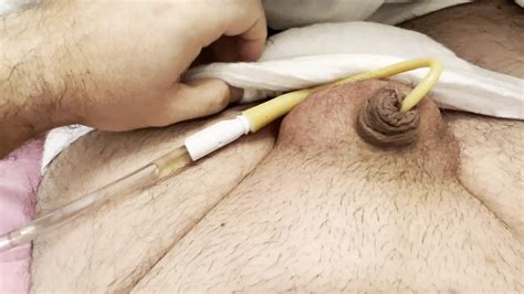 Ch Bladder Catheter Insertion Italian Gay Man Porn Xhamster