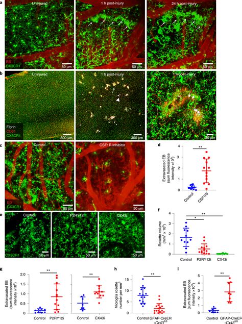 Microglia Rapidly Extend Processes And Create A Barrier Surrounding