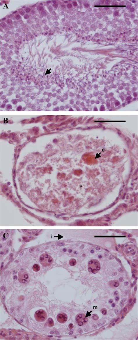 Cross Section Of Individual Testicular Tubules Assessed By Light