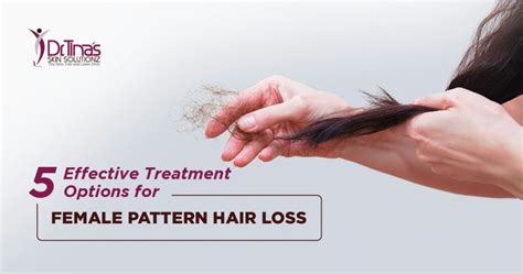 5 Effective Treatment Options for Female Pattern Hair Loss - Skin Solutionz