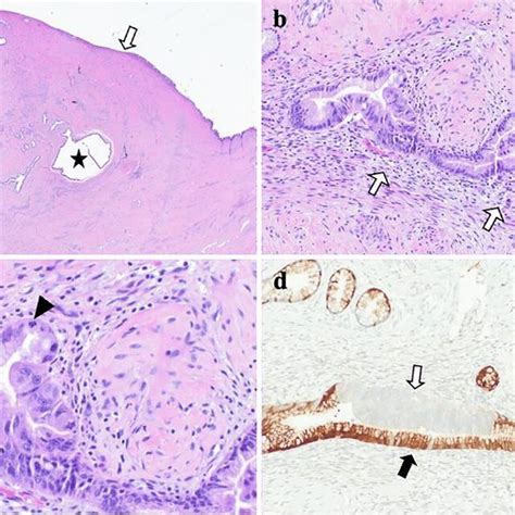 Resection Specimen From A 46 Year Old Female Initially Worked Up For A Download Scientific