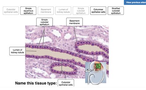 Simple Squamous Epithelium Slide Labeled