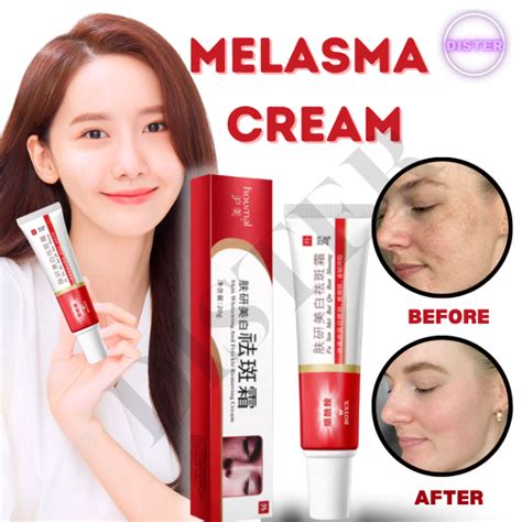 Melasma Cream Pekas Remover Collagen Japan Original Skin Whitening