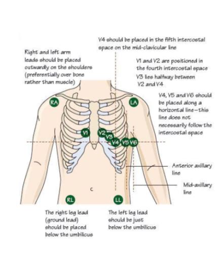 Ekgs Flashcards Quizlet