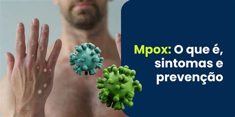 Mpox O Que Sintomas E Preven O Distribuir