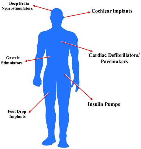 Implantable medical devices for various applications. | Download Scientific Diagram