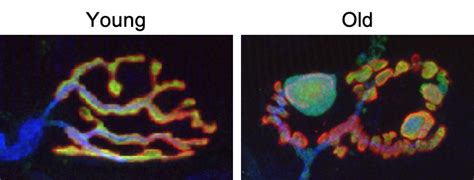 SYNAPSE FORMATION, STABILITY and REPAIR – THE VALDEZ LAB