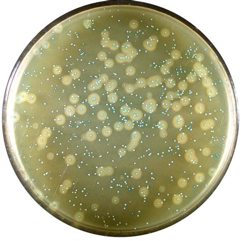 Aloa Agar Listeria Acc To Ottaviani Agosti Biolife Cromogeni