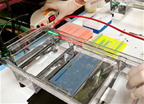 Electrophoresis Ask A Biologist 0 Hot Sex Picture