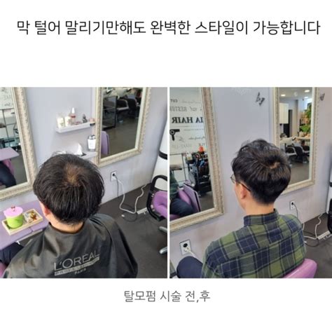 대구 탈모전문미용실 남자 정수리 탈모커버 잘하는 젤리아헤어 탈모펌 네이버 블로그