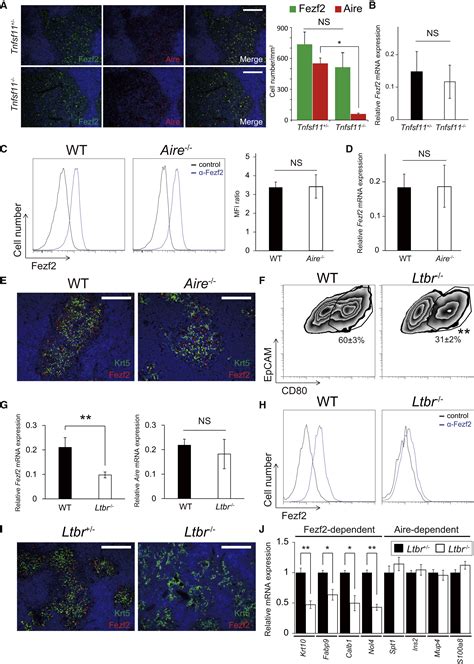 Fezf2 Orchestrates A Thymic Program Of Self Antigen Expression For