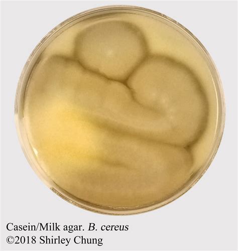 Microbiology Lab 26 Casein Nutrient Agar For Casease Basic Sciences