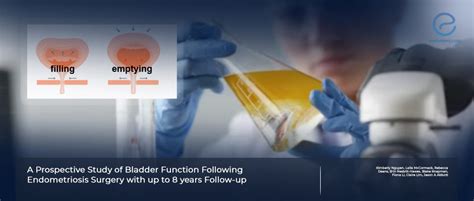 Bladder Function Alterations Following Endometriosis Surgery | EndoNews