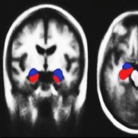 Hippocampus And Amygdala Position Download Scientific Diagram