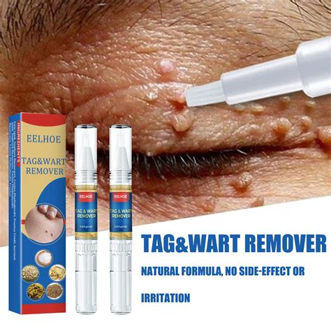 Eliminate Warts Flat Warts Black Spot Mole Removal Pen Genital Herpes