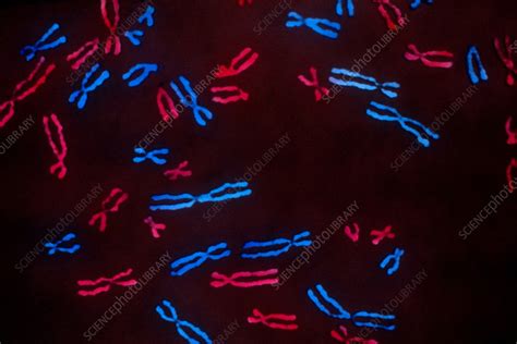 Metaphase Chromosomes - Stock Image - C044/8591 - Science Photo Library