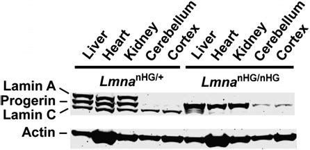 Western Blot Analysis Of Lamin A Lamin C And Progerin Expression In