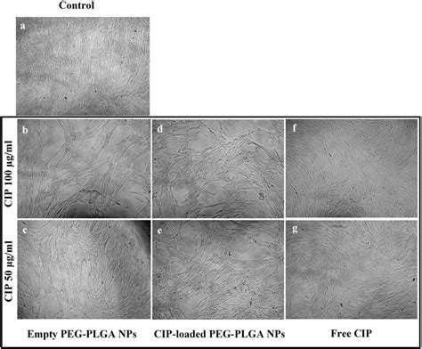 Stem Cells From The Apical Papilla SCAPs A Control Untreated