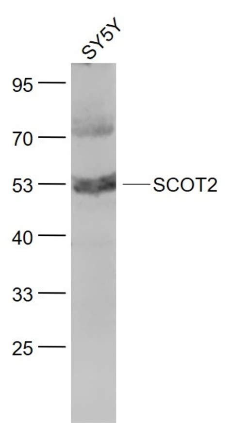 Scot Rabbit Anti Human Polyclonal Bioss L Unconjugated