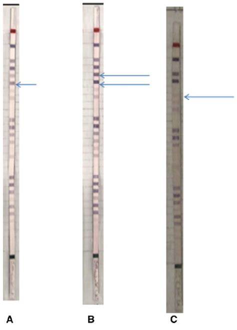 A Normal Genotype Aa B Heterozygous Genotype Ag C Mutant Genotype