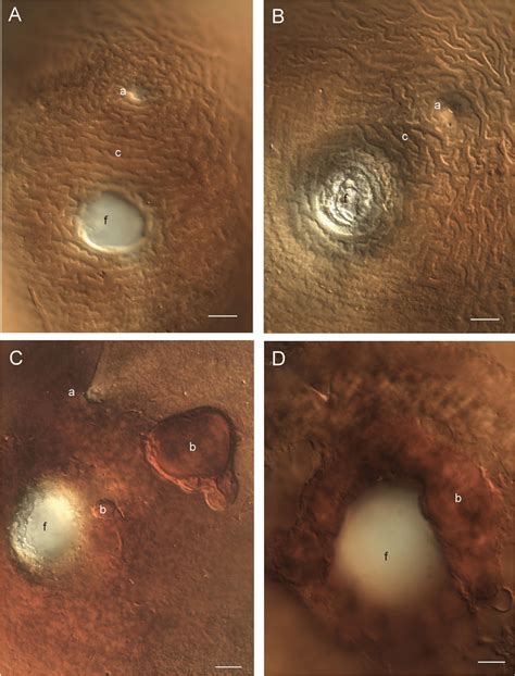 Vulvar Skin Lesions