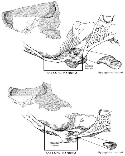 The Hypoglossal Canal And The Origin Of Human Vocal Behavior Pnas