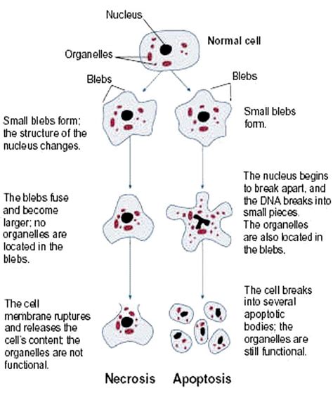 What Is Necrosis? What Are The Types Of Necrosis?