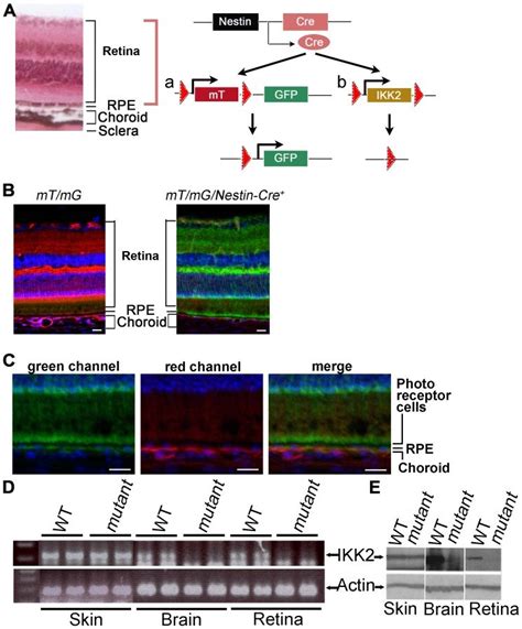 A Nestin Promoter Driven Cre Mediated Specific Deletion Of The Loxp