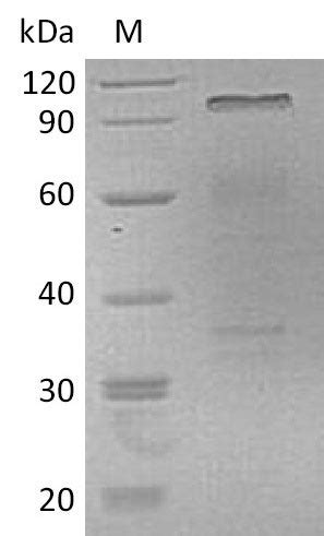 Recombinant Human Hepatocyte growth factor HGF Active 生长因子 武汉华美生物