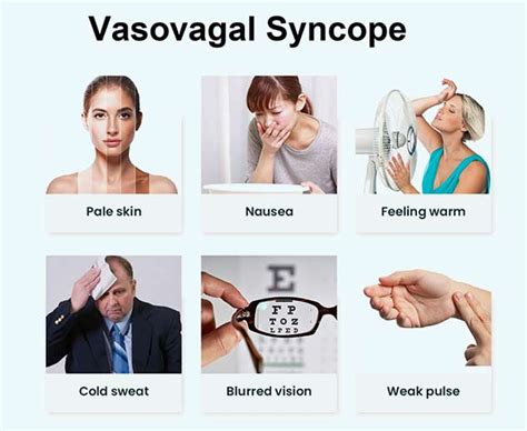 Vasovagal Syncope: Symptoms, Causes, Risk Factors | OnlyMyHealth