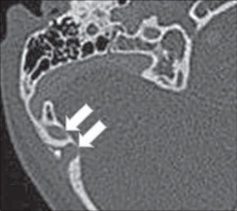 Scielo Brasil “leave Me Alone” Anatomical Structures And