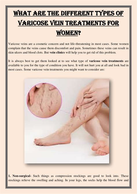 Ppt What Are The Different Types Of Varicose Vein Treatments For