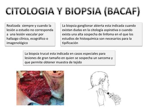 Enfoque Diagnostico De Masas De Cuello Pptx