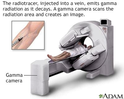 Reference tool for cardiac stress test - locationlasopa