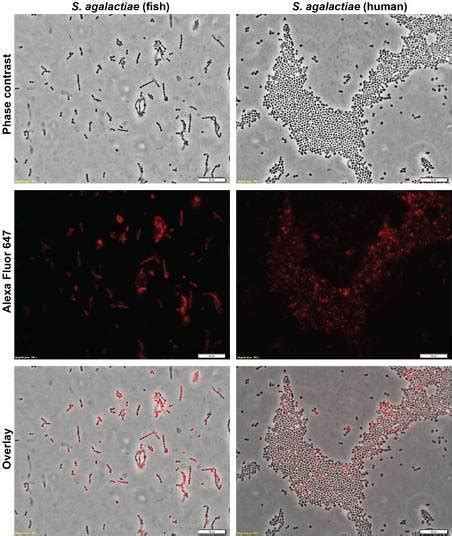 Fluorescence Microscopy Of Microorganisms After Immune Cytochemistry