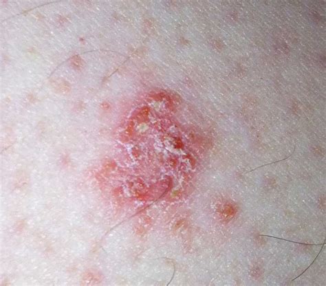 skin rashes on forearms - pictures, photos