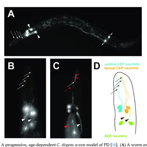 A progressive age dependent C elegans α syn model of PD 18 A A