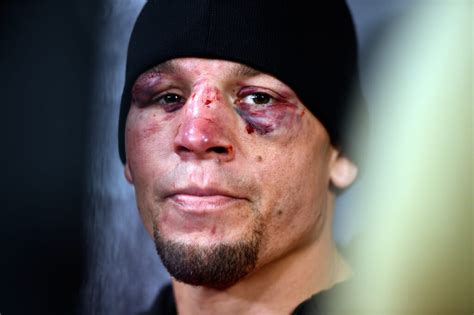 Nate Diaz Had To Vape Up After Ufc And Now He Might Be In Big