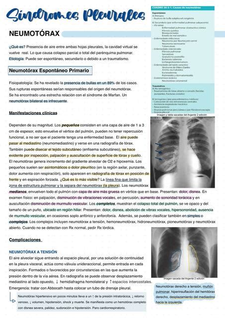 Síndromes Pleurales Semiología Josselyne Penafiel Medicina uDocz