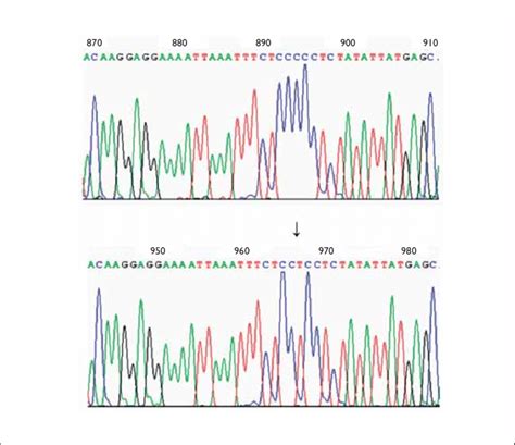 Nucleotidic Mutation In The Coi Gene Highlighted By Sequencing Of