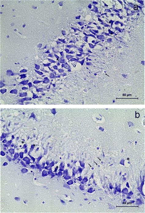 Hippocampus coronal section of rat treated with pilocarpine showing ... 